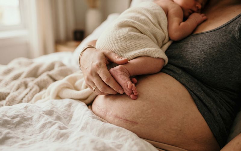 Babytrage nach Kaiserschnitt: Frauenärztin Dr. Rieke Hermann erklärt, was wirklich erlaubt ist