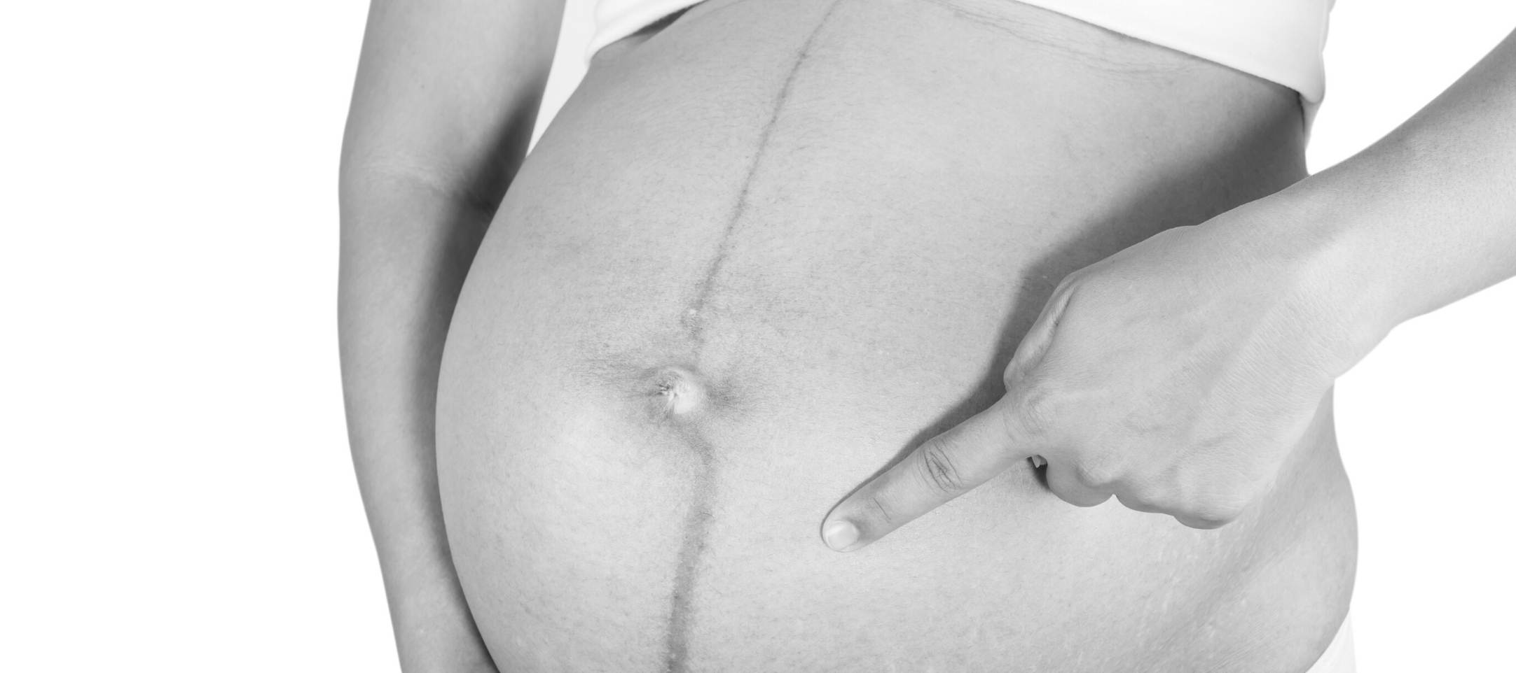 Schwangerschaftsstreifen? - Das hilft deiner Haut während der Schwangerschaft!