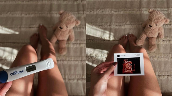 "Ich bin schwanger!": 7 Ideen, um deine Schwangerschaft zu verkünden